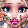 Ice Queen Lips Injections